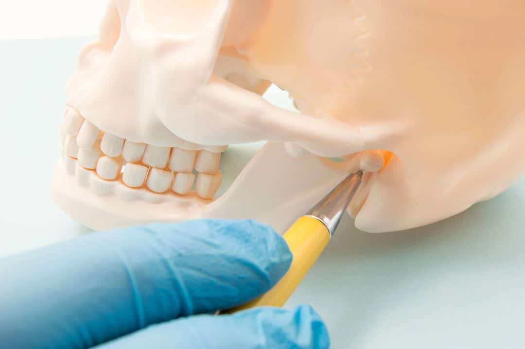 Tmj treatment dental model at Thrive Family Dentistry in Auburn, Alabama