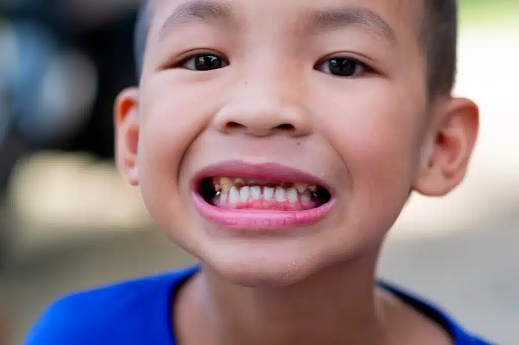Child with persistent bad breath
