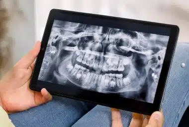 Pano Digital X Ray Machine