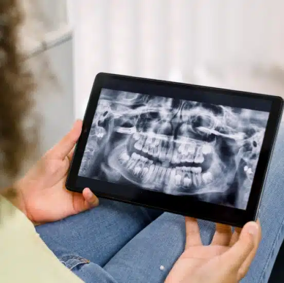 Patient viewing a digital panoramic dental X-ray on a tablet at TRU Dentistry SoCo in South Austin, TX