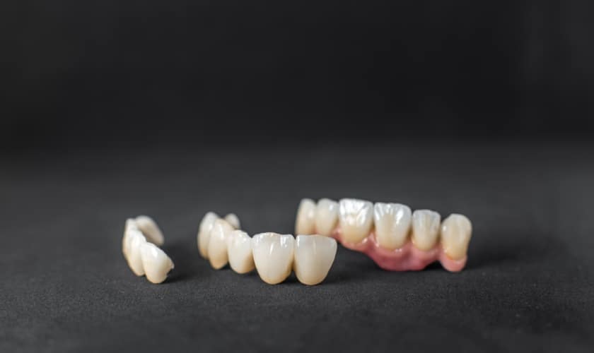 Dental Crowns do look and feel natural
