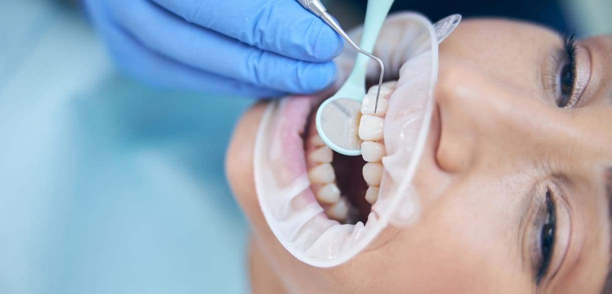 tooth filling aftercare dos and donts for a smooth recovery