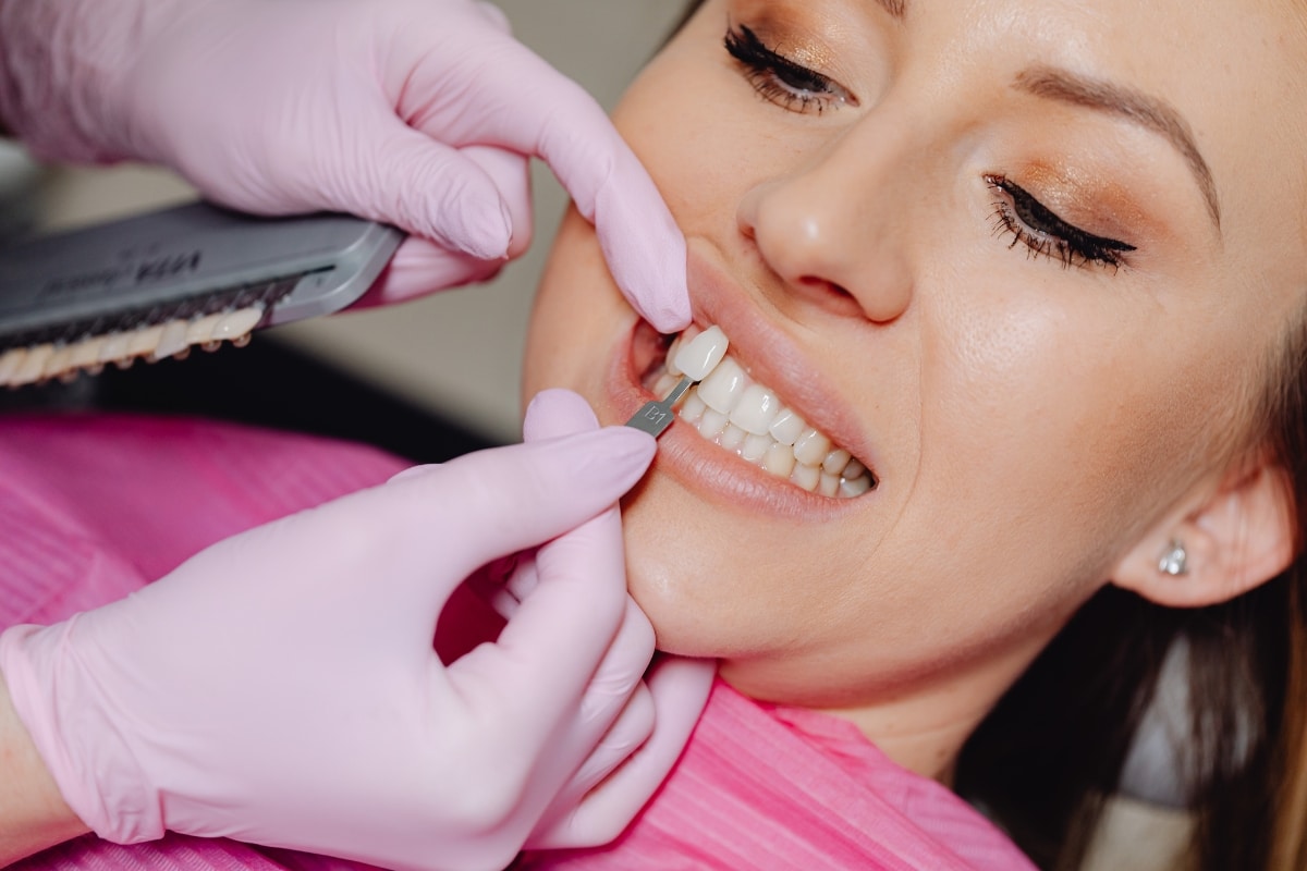 Veneers-in-Charlotte