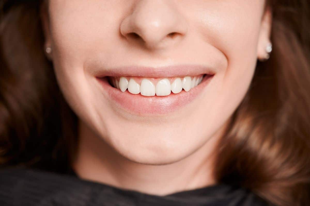 How Quickly Can I See Results After a Teeth Whitening Treatment?