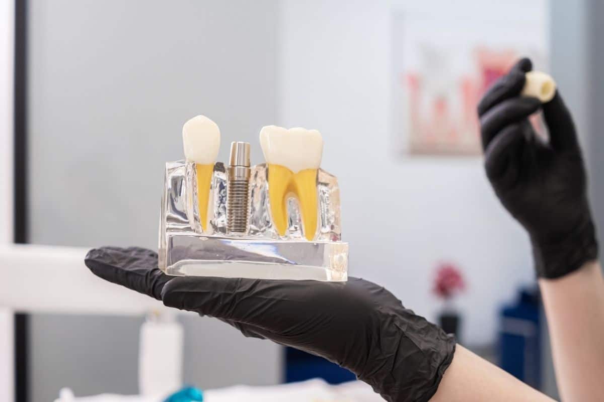 What Are the Early Warning Signs of Dental Implant Failure?