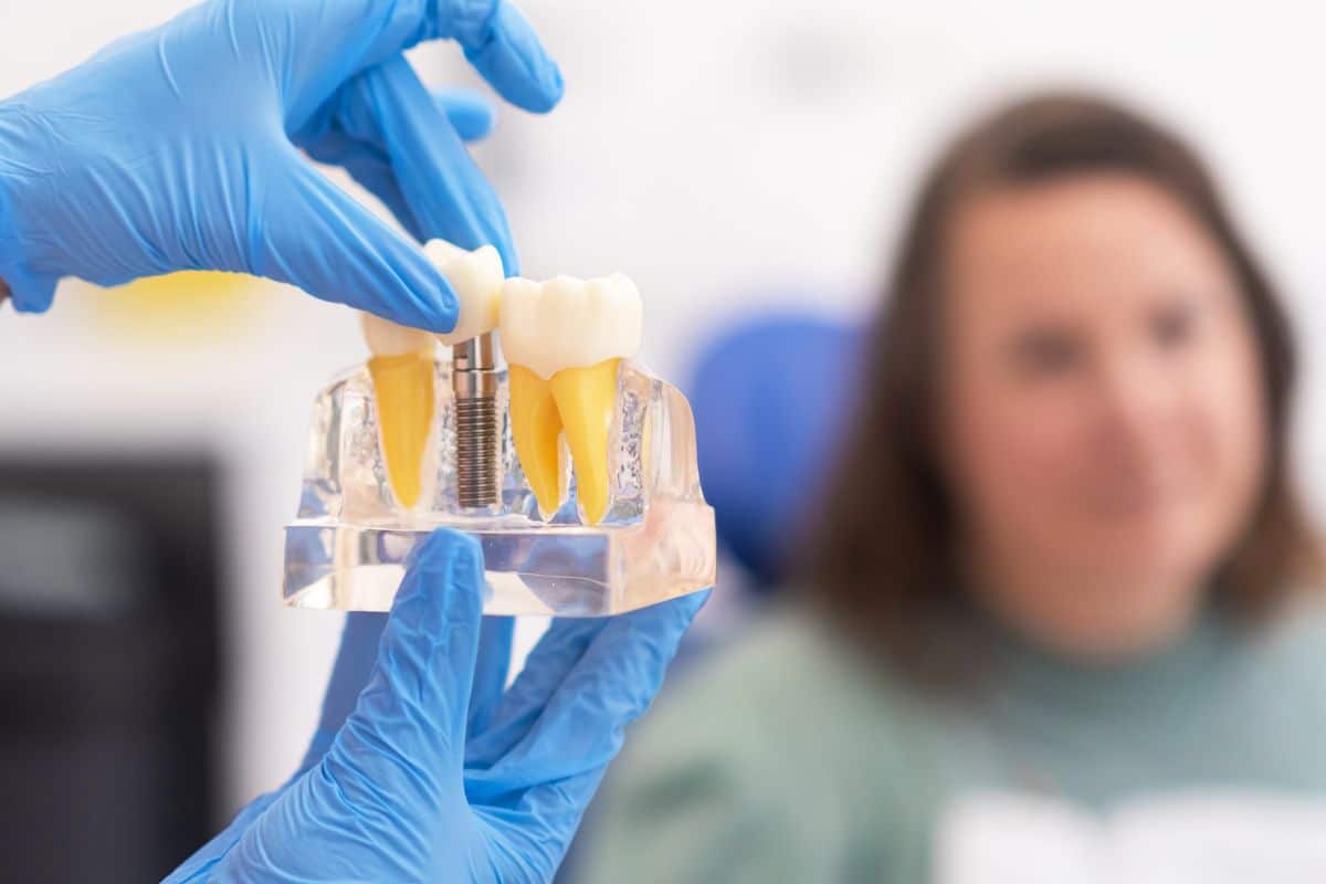 What Are the Early Signs That You May Need Dental Implants?