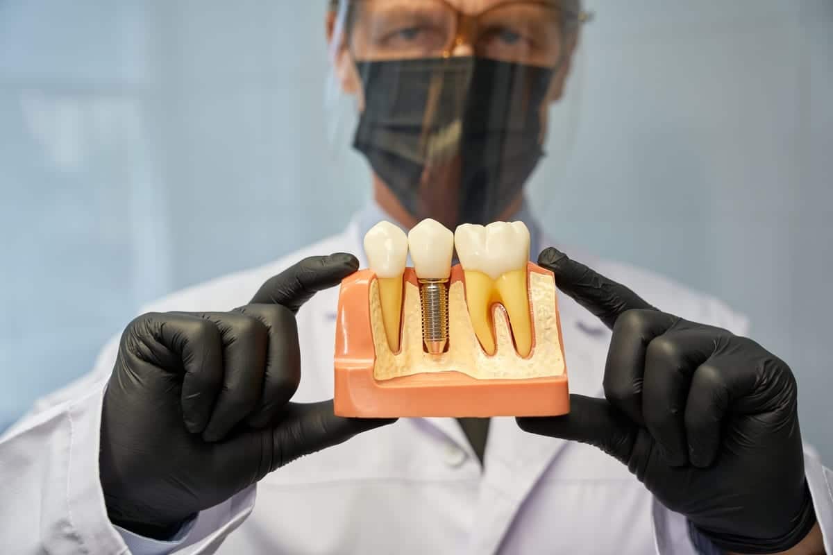 Dental Implants in Charlotte