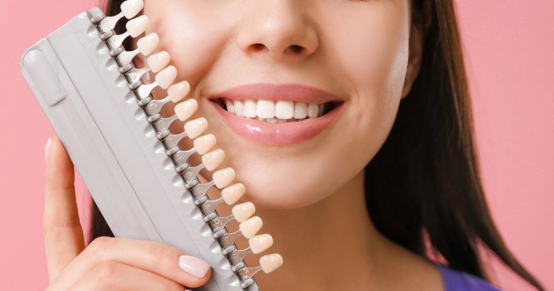 common concerns about porcelain veneers