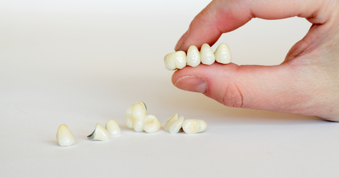 Rebuilding More Than Smiles The Holistic Impact of Crowns