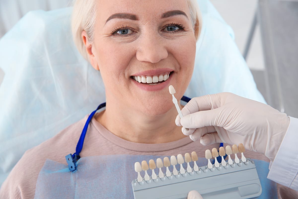 Veneers in Charlotte