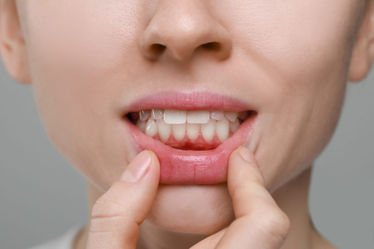 Periodontal Care in Riverview
