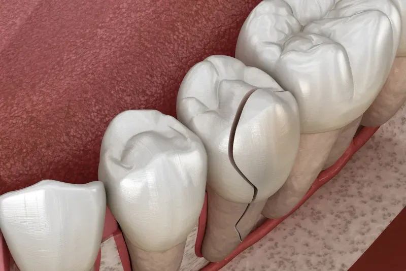 What Are The Signs Of A Dental Emergency?