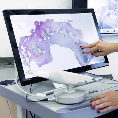 Dental digital scanner displaying a 3D image of teeth and gums on a computer screen