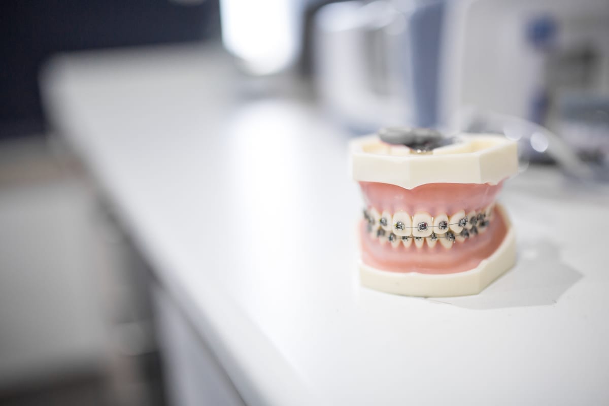 Orthodontics in Houston