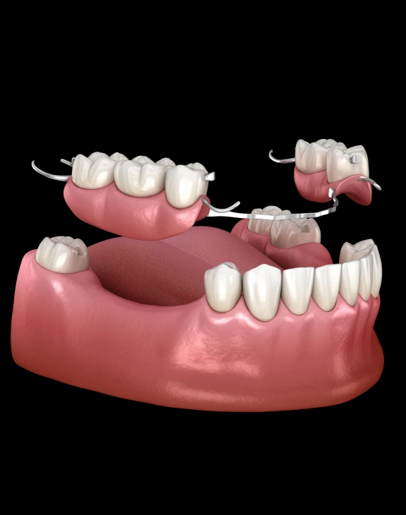 Dentures & Partials
