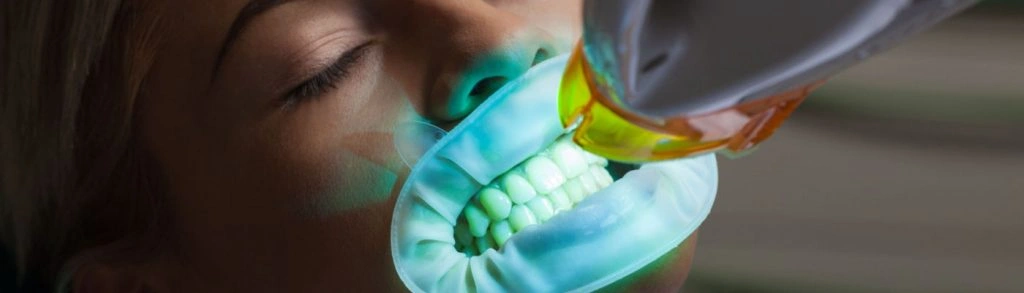 Professional Tooth Whitening in Kanata