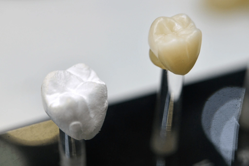 What Are Crowns Used For?