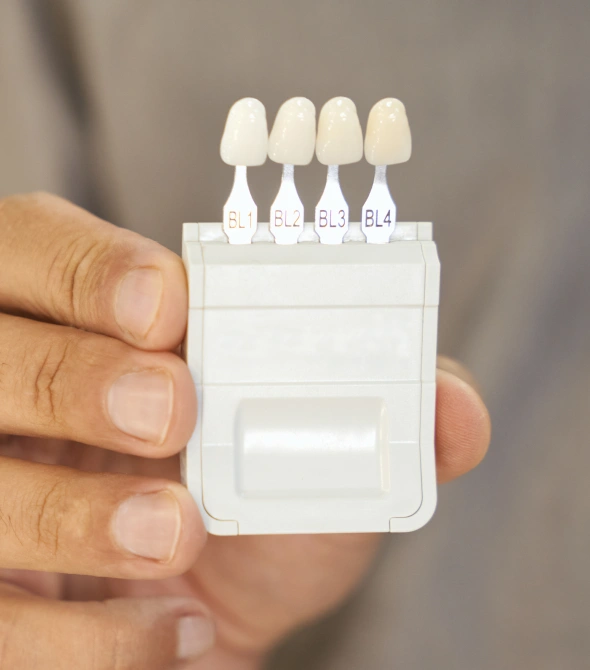 Porcelain veneers used to enhance the appearance of teeth