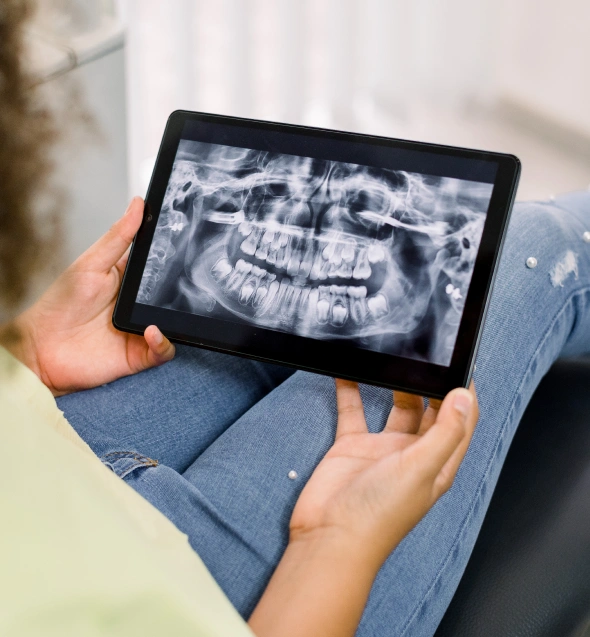 Digital dental X-ray used for accurate oral health diagnosis
