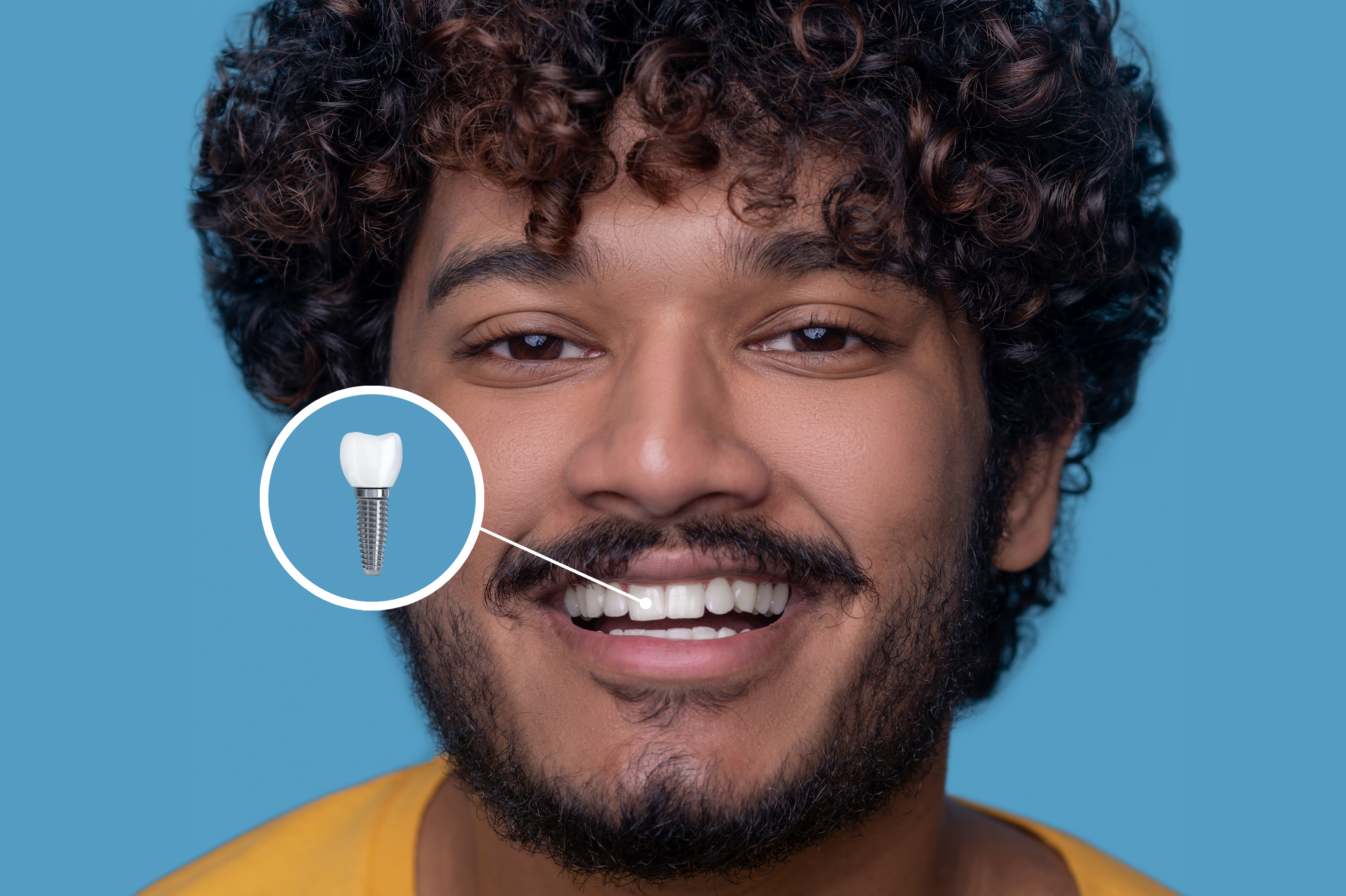 diet and aftercare of dental implants