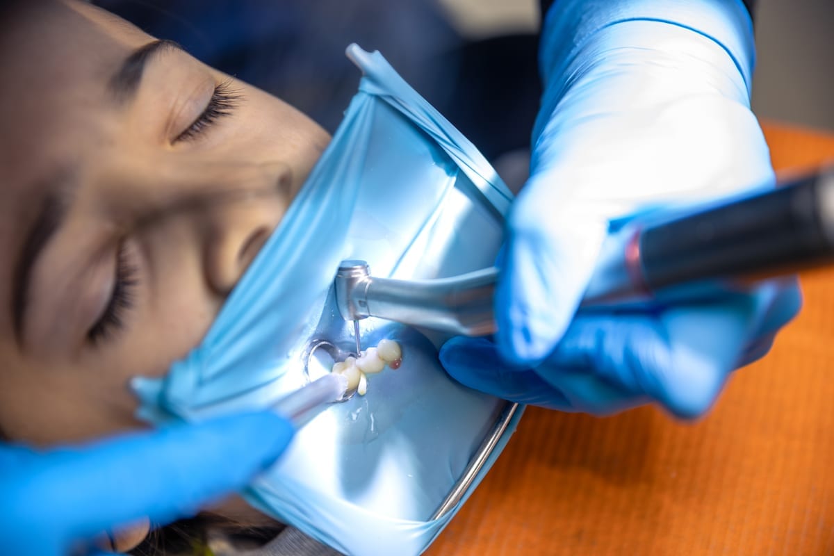 Root Canal Treatment in St. Johns