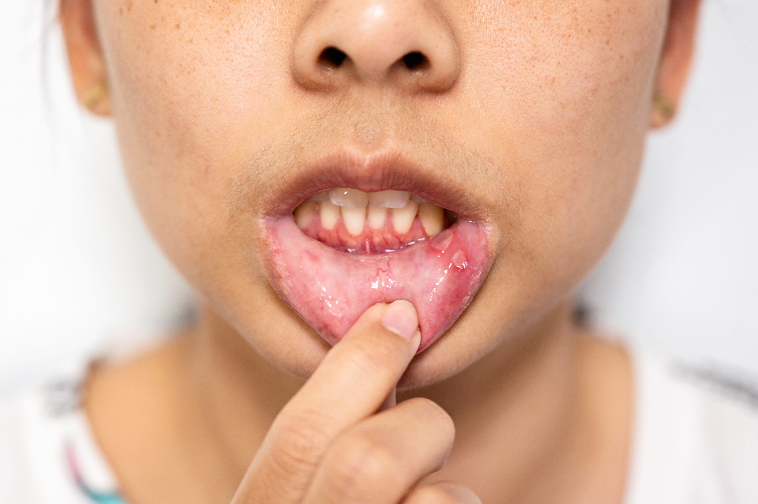 Why Periodontics is Essential for Long-Term Oral Health