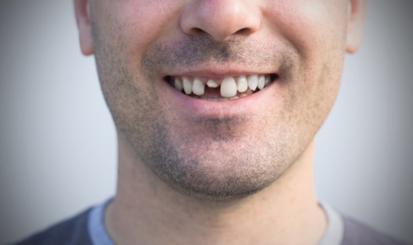 how to get a cracked tooth to stop hurting