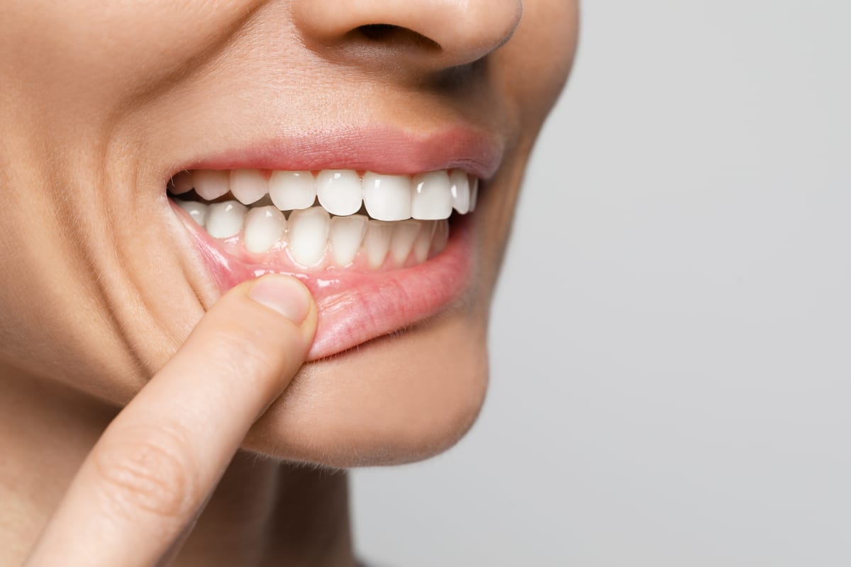 Gum Disease Treatment in Watford