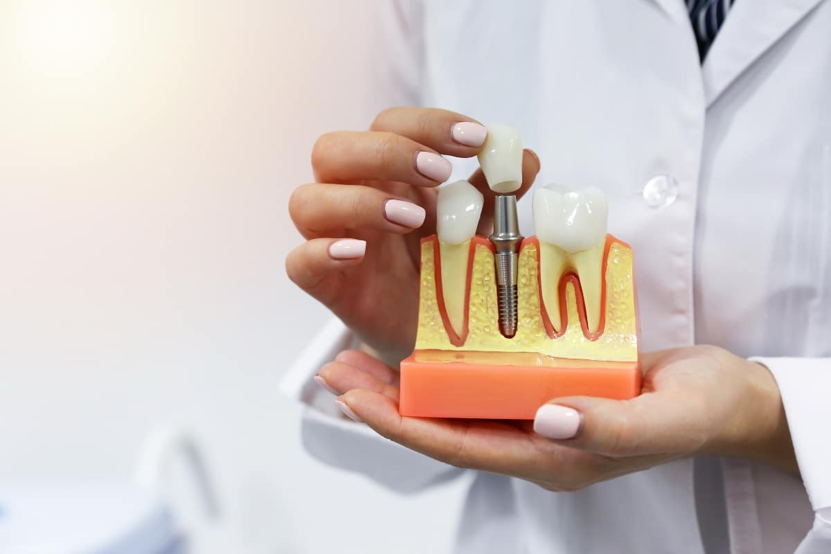 Dental implants in Walnut Creek
