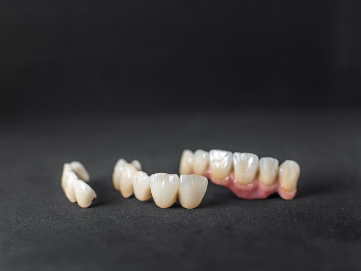 dental crowns walnut creek