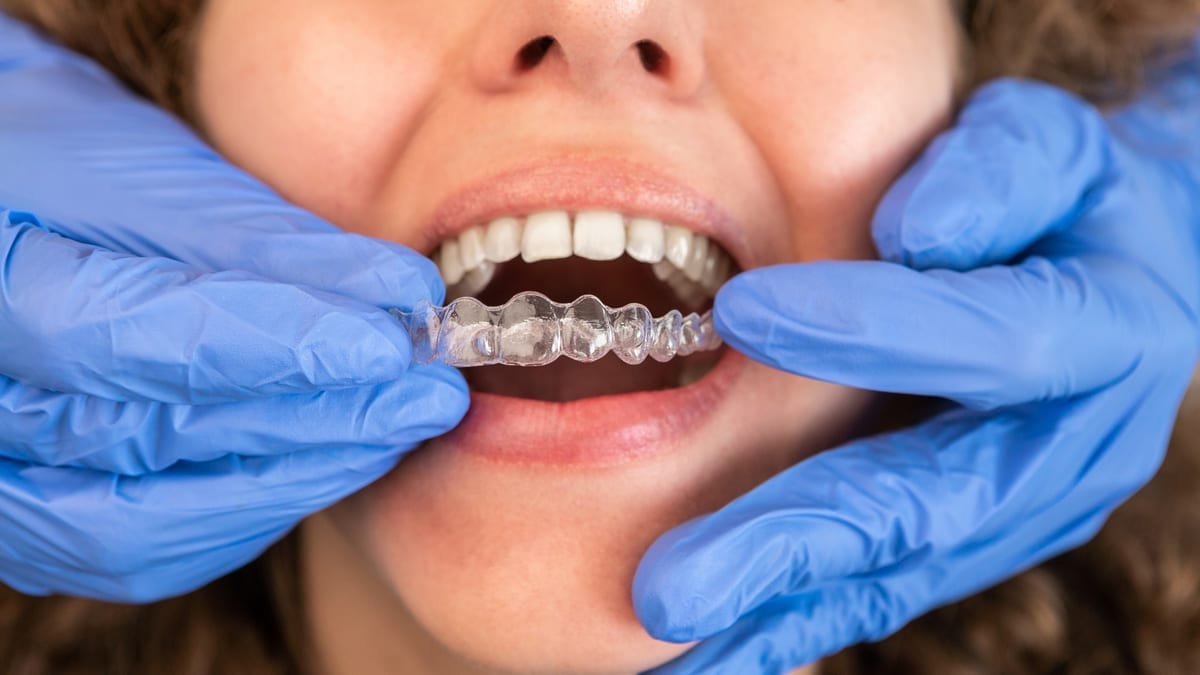 Invisalign in Walnut Creek