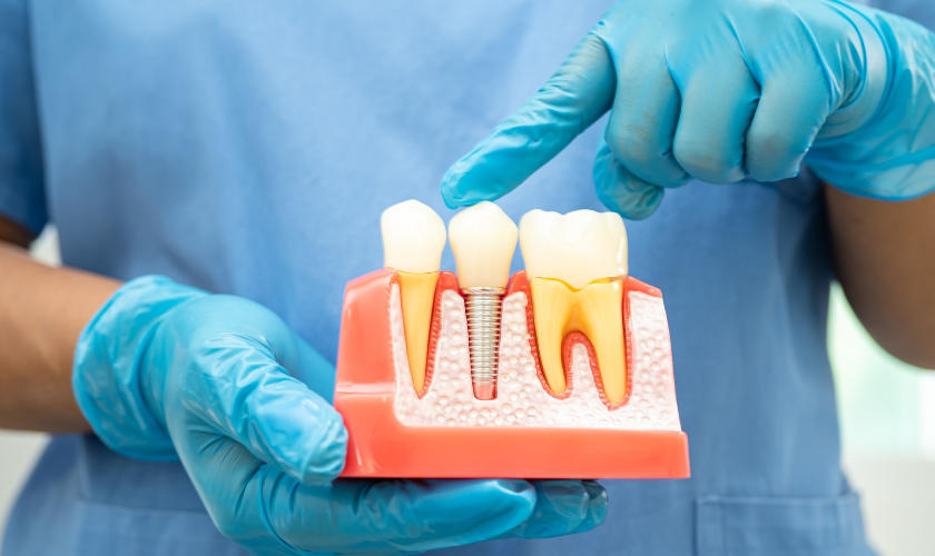 root canal treatment albany
