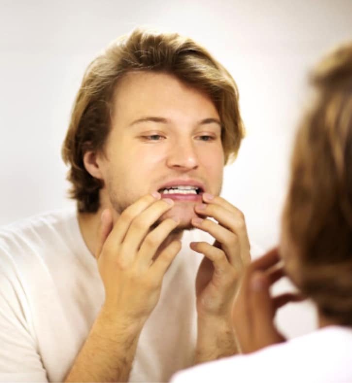Chipped tooth repair at at Westinghouse Dental in Georgetown