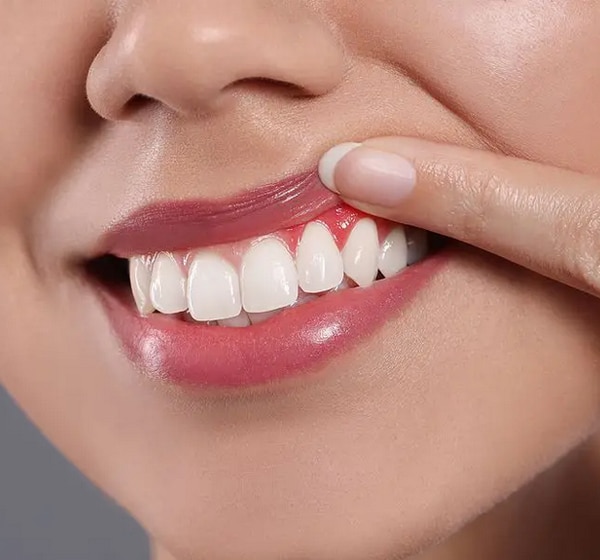 Woman receiving treatment for gum disease at Westinghouse Dental in Georgetown, TX