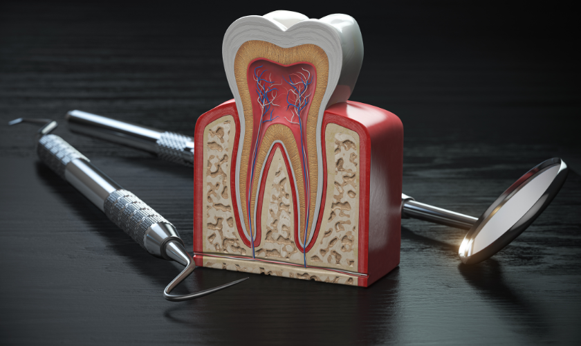 Does a Root Canal Cause Cancer or Other Health Problems