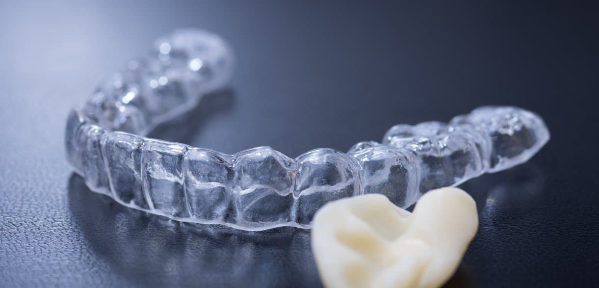 how occlusal guards help in managing jaw pain