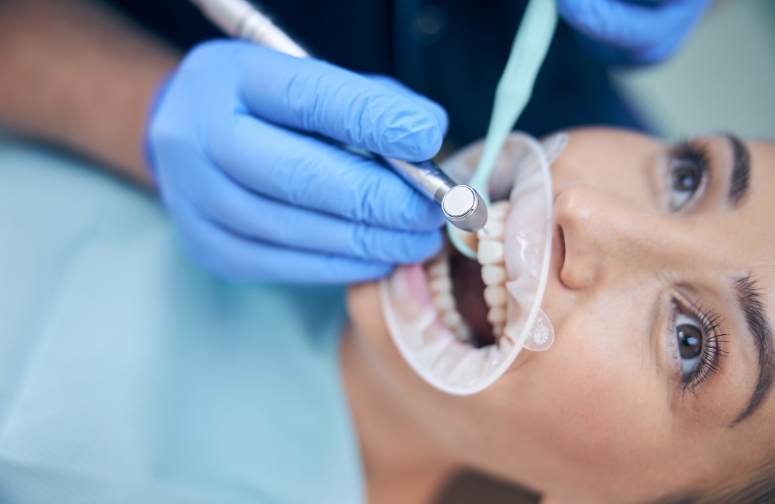 the minimalist smile makeover less is more in modern cosmetic dentistry