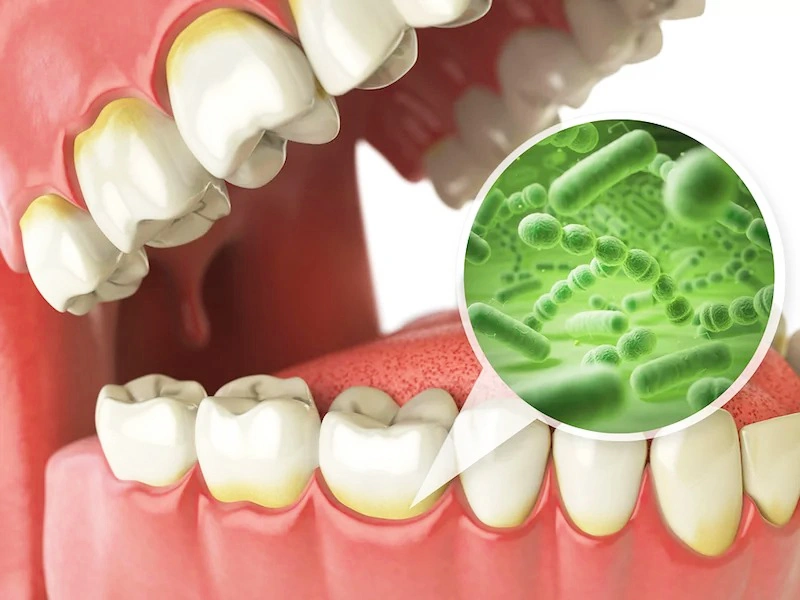 Regular teeth cleanings are essential for maintaining healthy teeth and good oral health