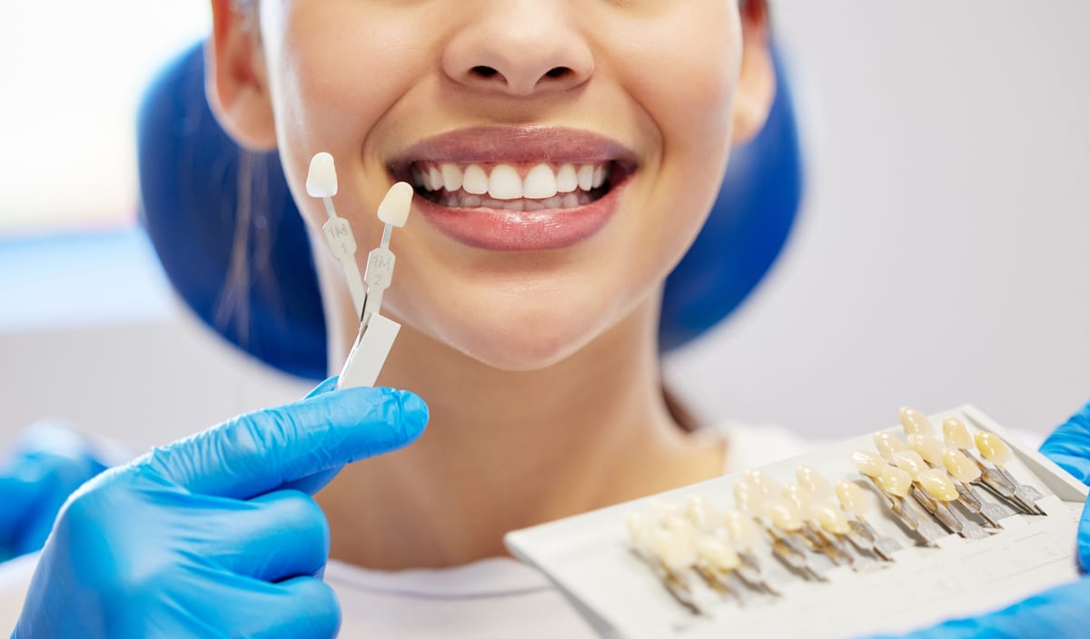 Veneers in The Woodlands