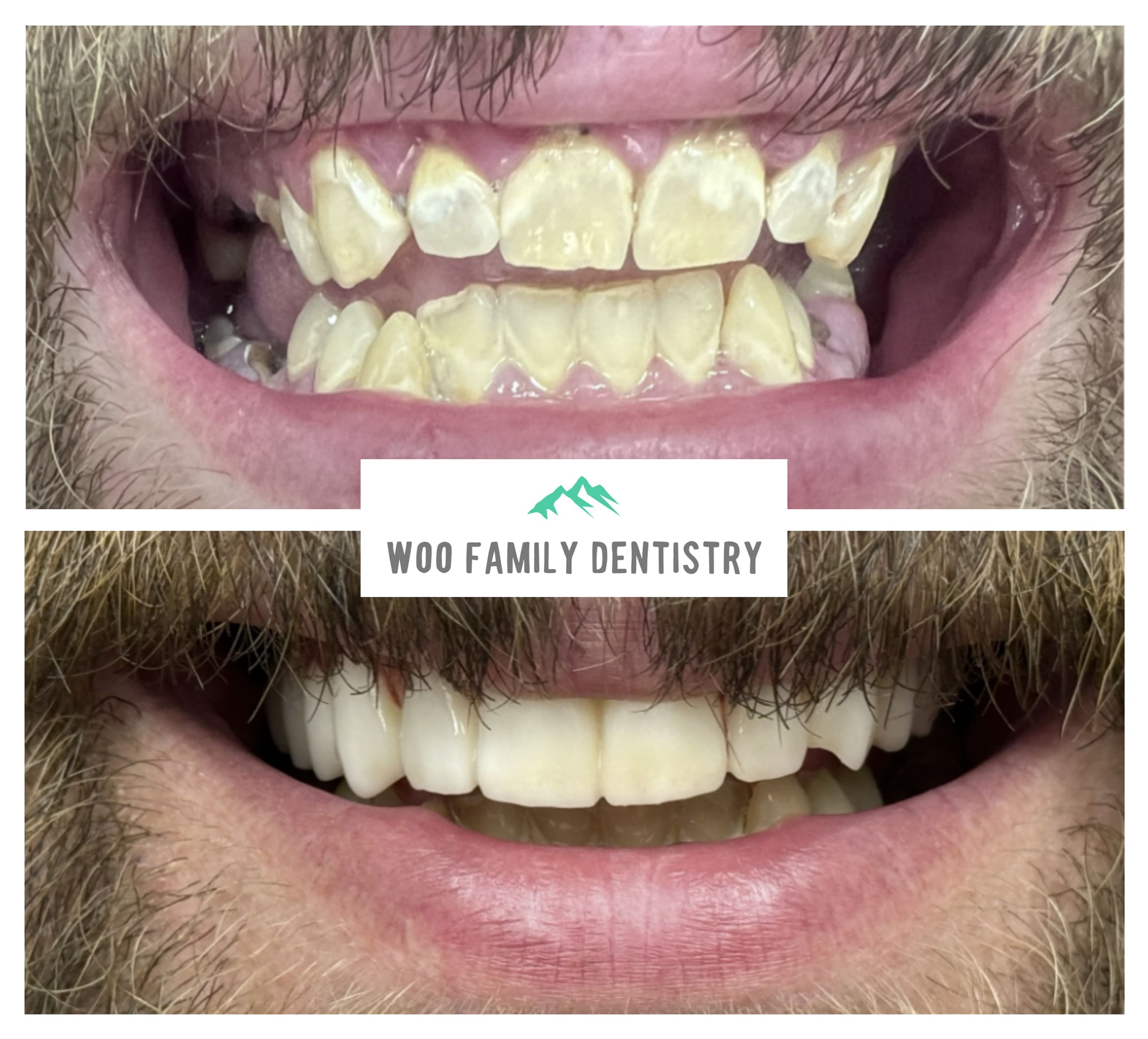 before-after-image