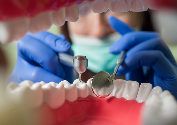 5 Signs That You May Need a Composite Filling To Restore Your Smile