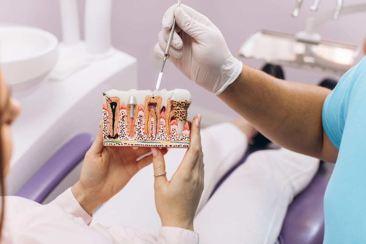 Root Canal Treatment in San Leandro