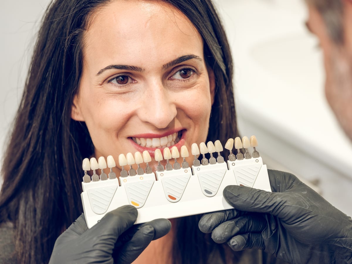 Veneers in San Antonio Heights