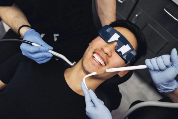Dental Sealants