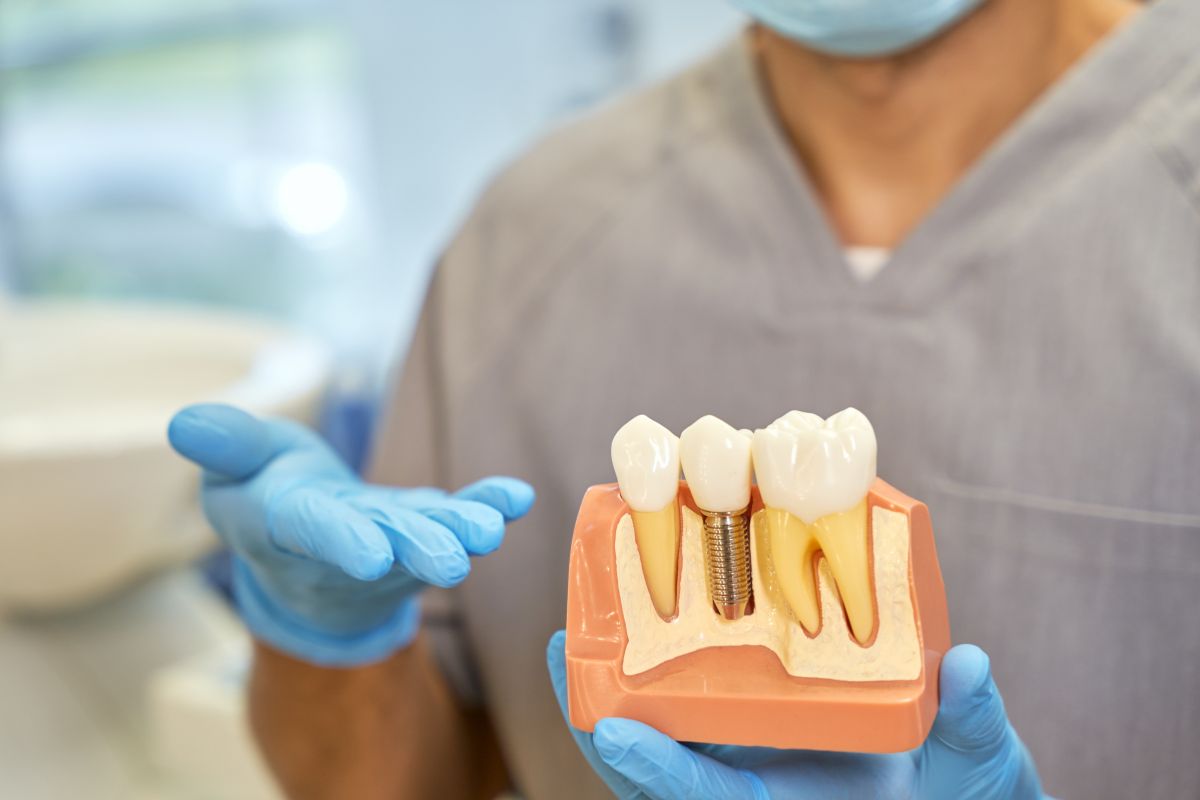 Why Waiting Too Long for a Dental Implant Can Cost You More